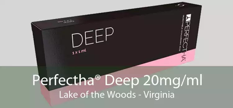 Perfectha® Deep 20mg/ml Lake of the Woods - Virginia